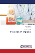 Occlusion in Implants - Garima Nichlani