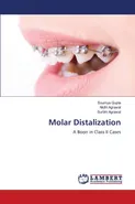 Molar Distalization - Soumya Gupta