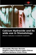 Calcium Hydroxide and its wide use in Stomatology - Borroto Alexander Morales