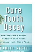 Cure Tooth Decay - Ramiel Nagel