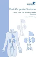 Pelvic Congestion Syndrome - Chronic Pelvic Pain and Pelvic Venous Disorders - Mark S Whiteley