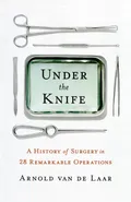 Under the Knife - van de Laar Arnold