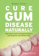Cure Gum Disease Naturally - Ramiel Nagel