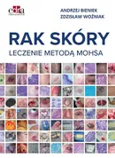 Rak skóry Leczenie metodą Mohsa - Andrzej Bieniek