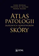 Atlas patologii złośliwych nowotworów skóry - Andrzej Kaszuba