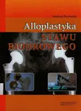 Alloplastyka stawu biodrowego - Andrzej Pozowski