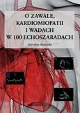 O zawale kardiomiopatii i wadach w 100 echoszaradach - Outlet - Mirosław Kowalski