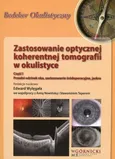 Zastosowanie optycznej koherentnej tomografii w okulistyce Część 1 - Edward Wylęgała