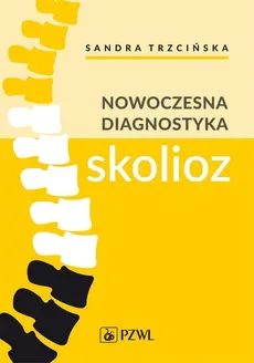 Nowoczesna diagnostyka skolioz - Outlet - Kamil Koszela, Andrzej Myśliwiec, Sandra Trzcińska, Arkadiusz Żurawski