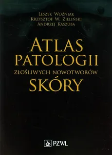 Atlas patologii złośliwych nowotworów skóry - Outlet - Andrzej Kaszuba, Krzysztof W. Zieliński, Leszek Woźniak