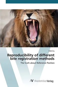 Reproducibility of different bite registration methods - Előd Úry