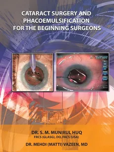 Cataract Surgery And Phacoemulsification For The Beginning Surgeons - Dr.S.M.Munirul Huq