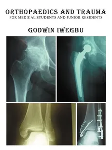 Orthopaedics and Trauma for Medical Students and Junior Residents - Godwin Iwegbu