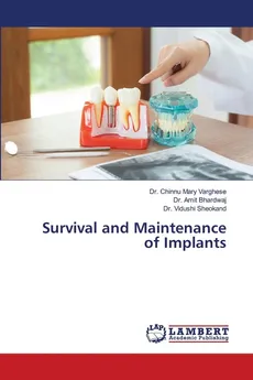 Survival and Maintenance of Implants - Dr. Chinnu Mary Varghese