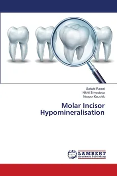 Molar Incisor Hypomineralisation - Sakshi Rawal