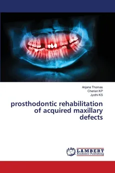 prosthodontic rehabilitation of acquired maxillary defects - Anjana Thomas