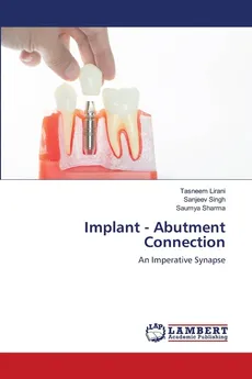 Implant - Abutment Connection - Tasneem Lirani