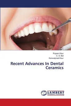 Recent Advances In Dental Ceramics - Rupam kaur