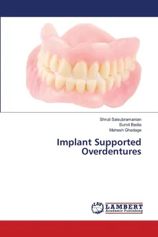Implant Supported Overdentures - Shruti Saisubramanian