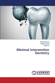 Minimal Intervention Dentistry - Sudharsana S