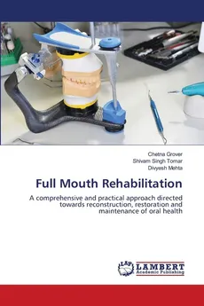 Full Mouth Rehabilitation - Chetna Grover