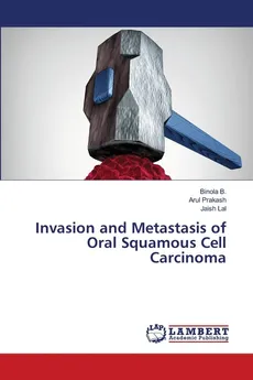 Invasion and Metastasis of Oral Squamous Cell Carcinoma - Binola B.