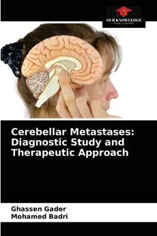 Cerebellar Metastases - Ghassen Gader