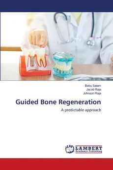 Guided Bone Regeneration - Babu Salam