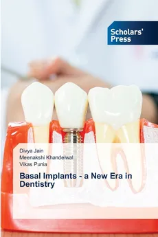 Basal Implants - a New Era in Dentistry - Divya Jain