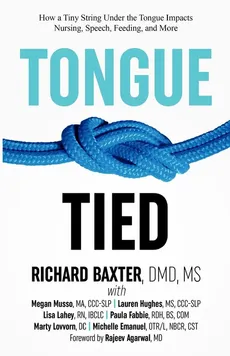 Tongue-Tied - DMD MS Baxter