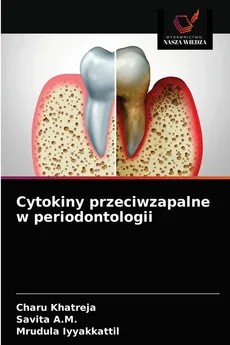 Cytokiny przeciwzapalne w periodontologii - Charu Khatreja