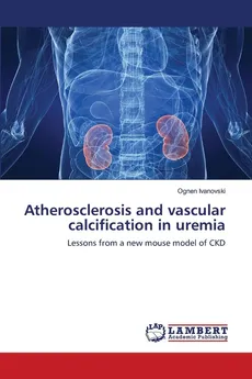 Atherosclerosis and vascular calcification in uremia - Ognen Ivanovski