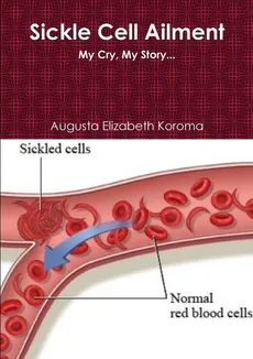 Sickle Cell - Augusta Elizabeth Koroma