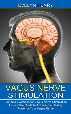 Vagus Nerve Stimulation - Evelyn Henry