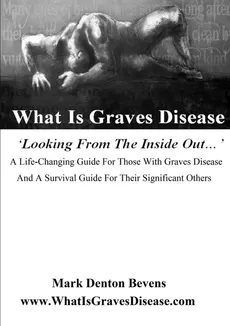 What Is Graves Disease - Bevens Mark Denton