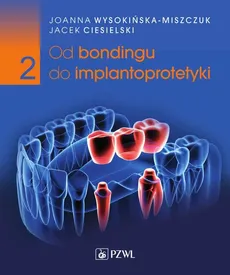 Od bondingu do implantoprotetyki Część 2 - Ciesielski Jacek, Joanna Wysokińska-Miszczuk