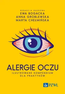Alergie oczu. Ilustrowane kompendium dla praktyków - Ewa Bogacka, Marta Chełmińska, Anna Groblewska