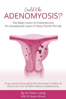 Adenomyosis -The Bad Cousin of Endometriosis - Eisen Liang
