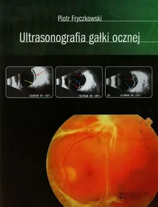 Ultrasonografia gałki ocznej - Outlet - Piotr Fryczkowski