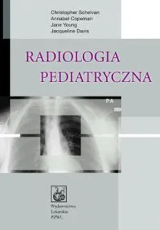 Radiologia pediatryczna - Annabel Copeman, Jacqueline Davis, Christopher Schelvan, Jane Young