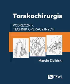 Torakochirurgia - Outlet - Marcin Zieliński
