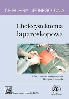 Chirurgia jednego dnia Cholecystektomia laparoskopowa