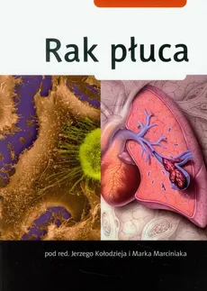Rak płuca