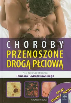 Choroby przenoszone drogą płciową z płytą CD - Tomasz Mroczkowski