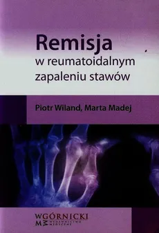 Remisja w reumatoidalnym zapaleniu stawów - Outlet - Marta Madej, Piotr Wiland