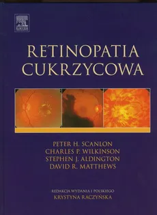 Retinopatia cukrzycowa - Outlet - Aldington Stephen J., Matthews David R., Scanlon Peter H., Wilkinson Charles P.