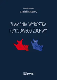 Złamania wyrostka kłykciowego żuchwy - Kozakiewicz Marcin