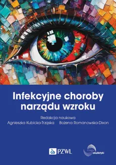 Infekcyjne choroby narządu wzroku - Bożena Romanowska-Dixon, Kubicka-Trząska Agnieszka