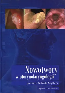 Nowotwory w otorynolaryngologii - Outlet