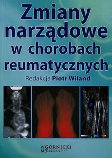 Zmiany narządowe w chorobach reumatycznych - Outlet - Piotr Wiland